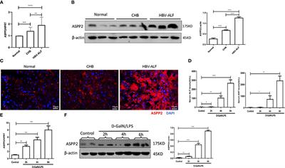 Enhancing ASPP2 promotes acute liver injury via an inflammatory immunoregulatory mechanism
